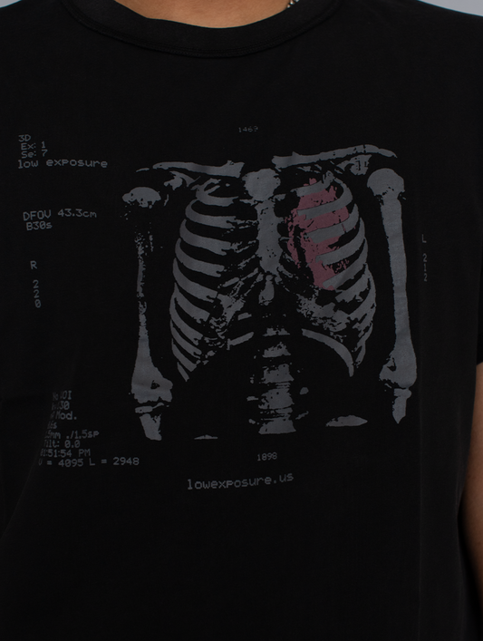THE MRI GRAPHIC TEE